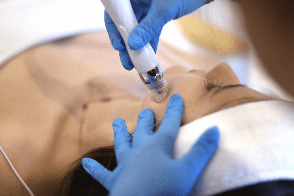 Oczyszczanie wodorowe