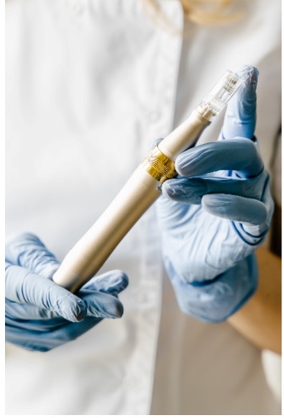 5 powodów dla mezoterapii mikroigłowej