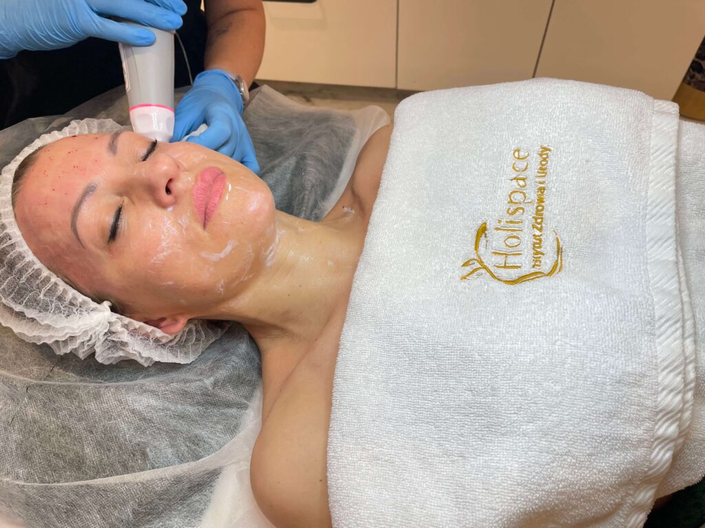 Radiofrekwencja Mikroigłowa w Holispace