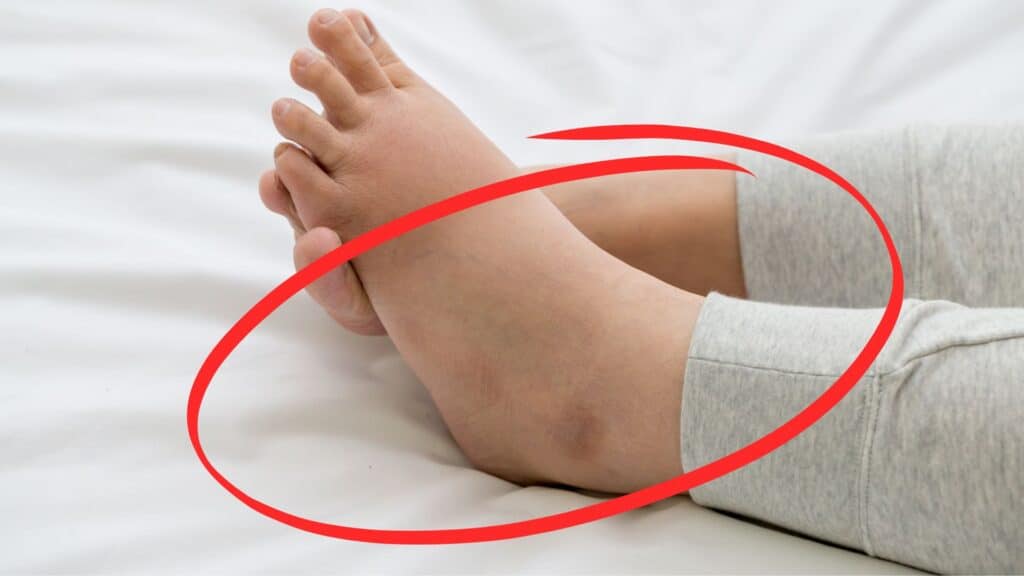 Zioła dla układu limfatycznego